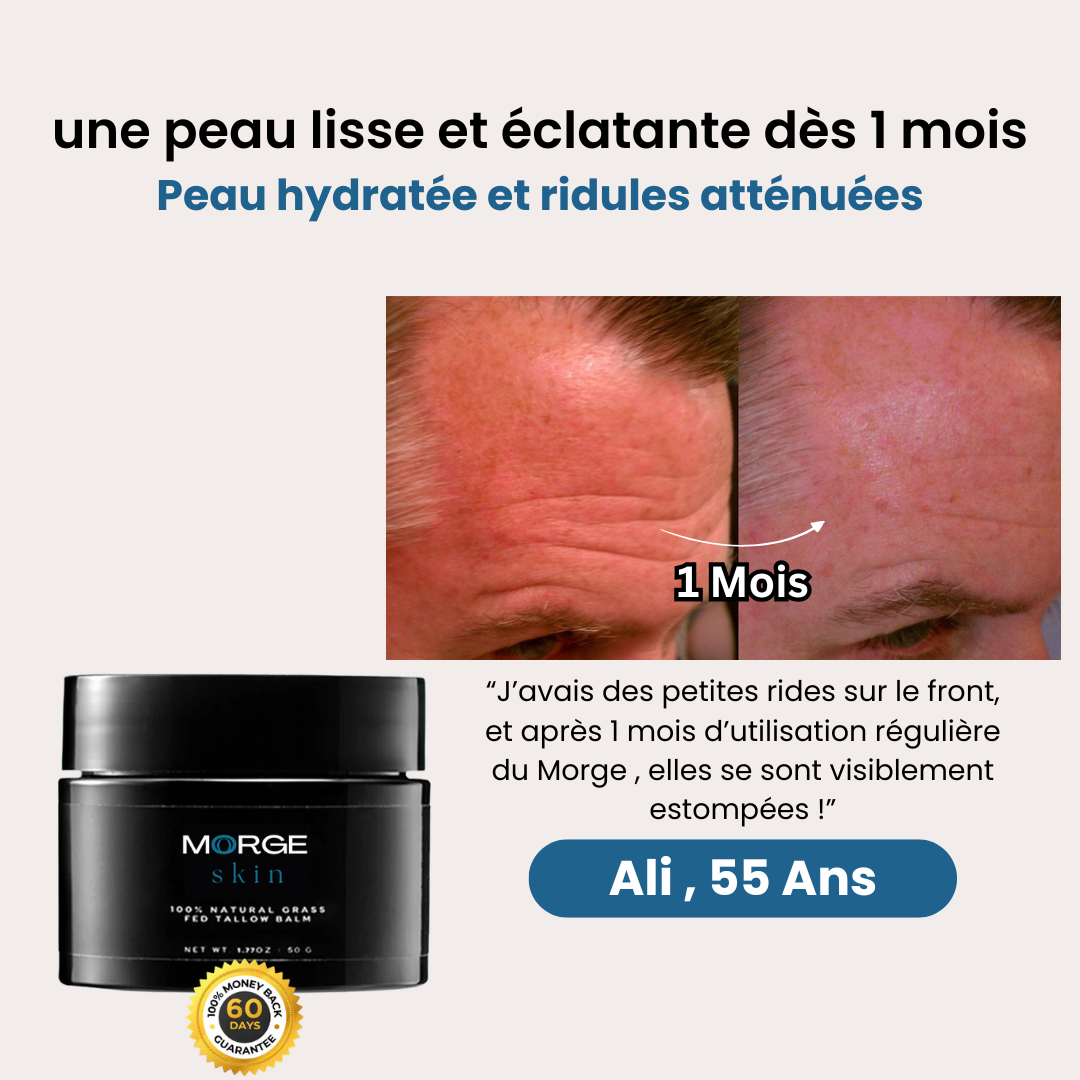 Morge Anti-Rides : réduisez les rides et retrouvez une peau jeune naturellement