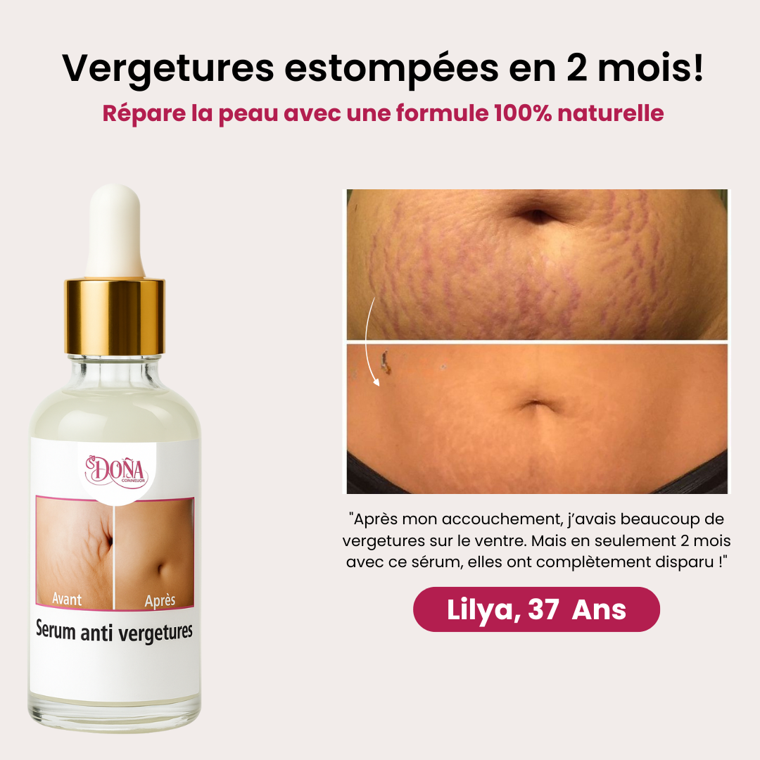 Ladona : des vergetures atténuées et une peau plus lisse en quelques semaines !