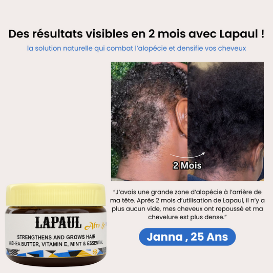 LAPAUL Crème : stoppez l’alopécie, stimulez la pousse et comblez les zones clairsemées !