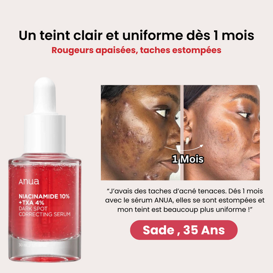 Sérum ANUA : réduit les taches pigmentaires et révèle un teint lumineux.