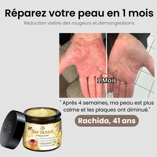 BEE VENOM™ : La solution pour calmer les irritations cutanées