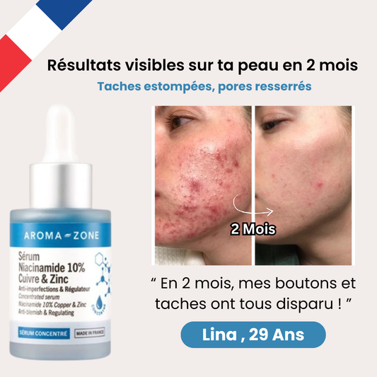 AROMAZONE™ : Niacinamide pour une peau parfaite